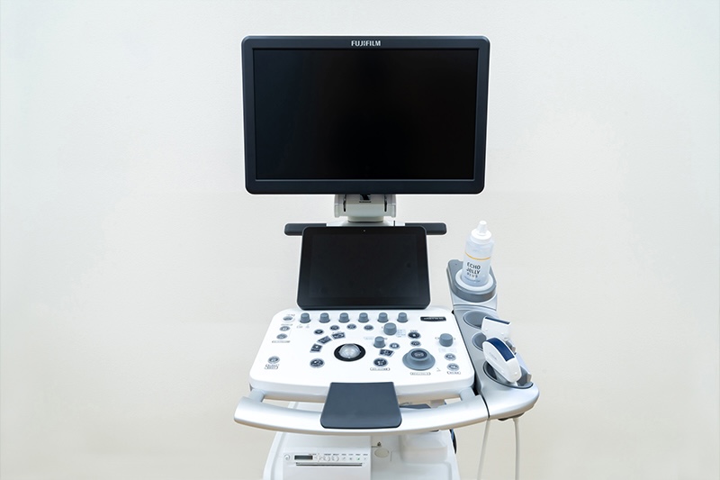 超音波検査装置（エコー）